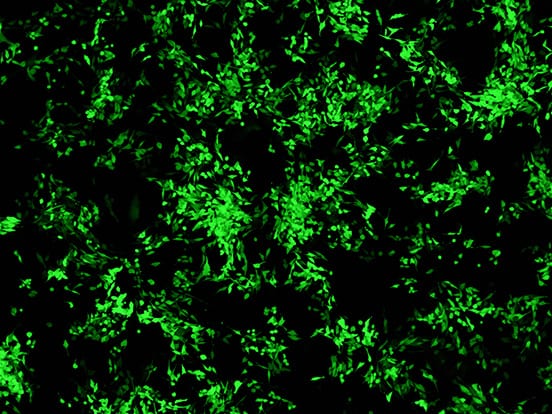 Transfection Reagents DNA, RNA, siRNA, & Protein | AMSBIO